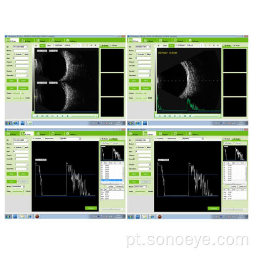 Scanner A / B Oftálmico Portátil